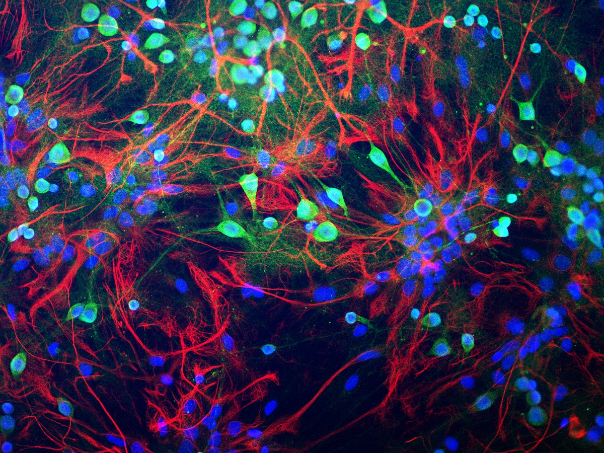 a colourful image of brain neurons