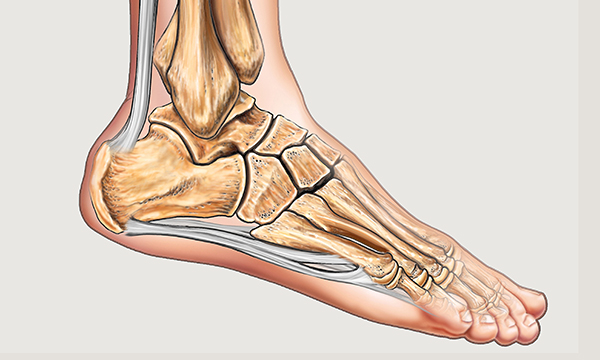 heel pressure ulcers
