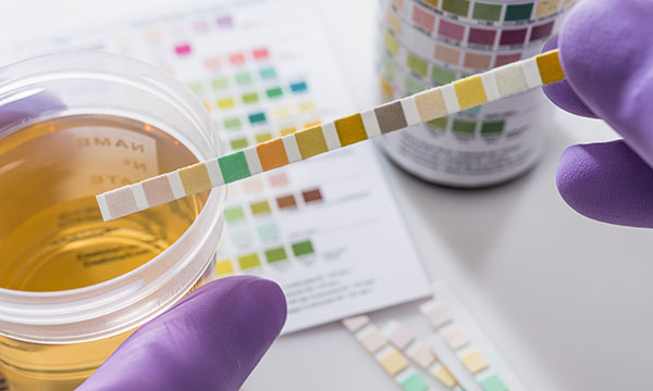 lower urinary tract symptoms