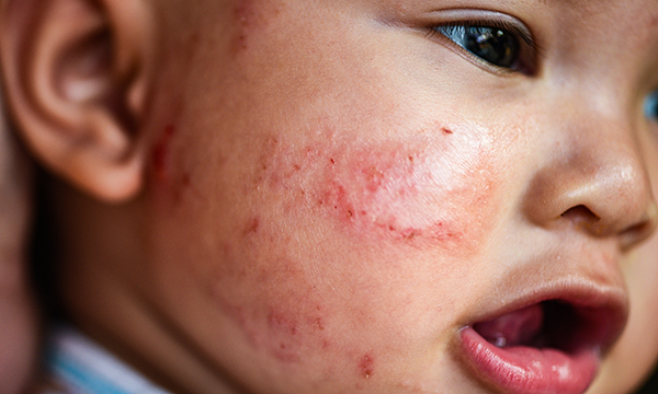skin structure
