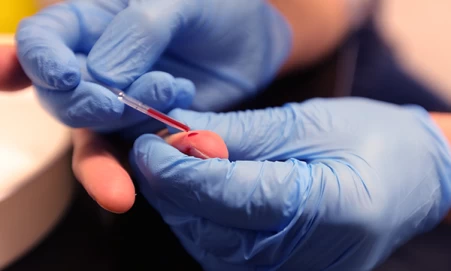 Living-with-HIV-transmission-prevention-treatment-and-care