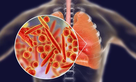 Preventing-healthcare-associated-respiratory-tract-infections