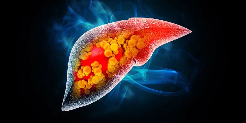 Unhealthy liver