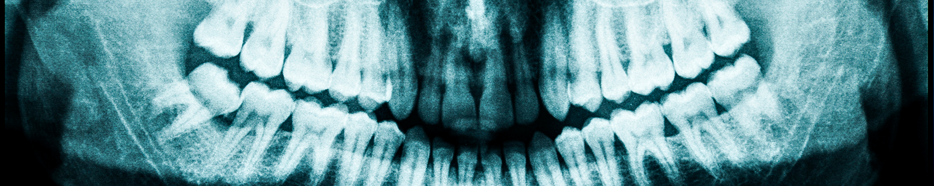 Maxillofacial and ENT forum X ray of jaw and teeth