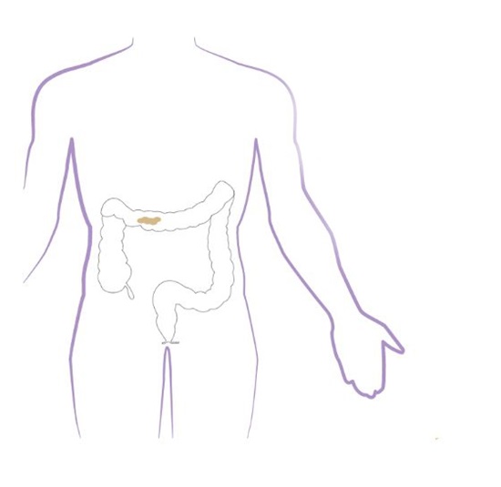 RCN Bladder and Bowel Learning Resource | Clinical Topics | Royal ...