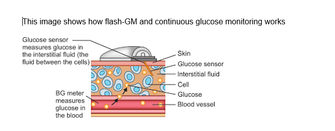 Flash GM and continuous glucose monitoring