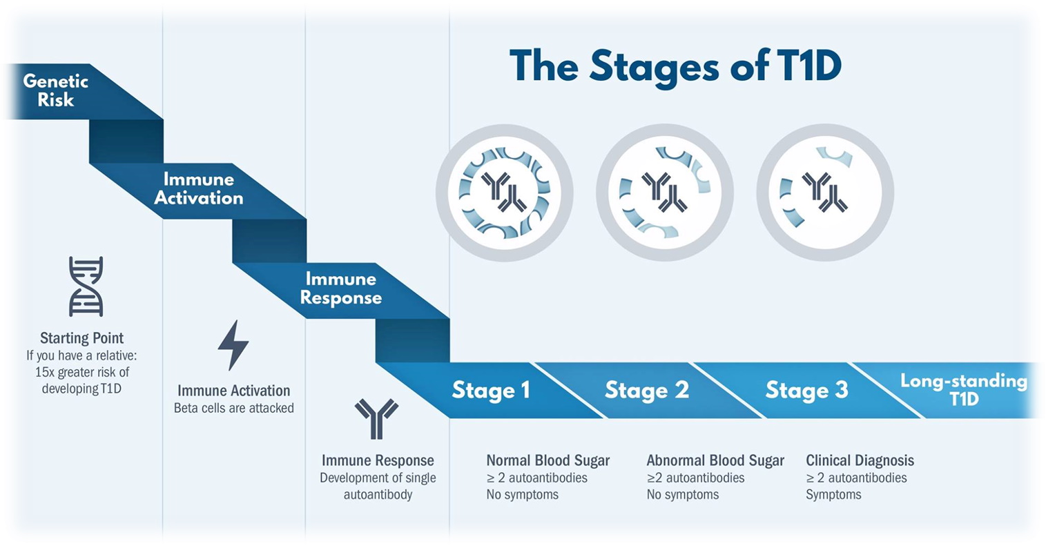 Diagram showing the stages of Type 1 diabetes