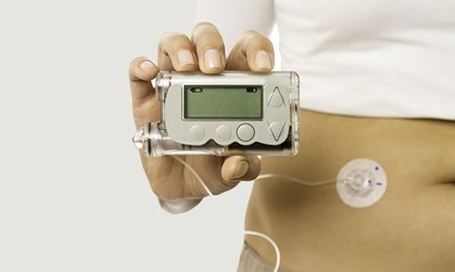 Insulin pump