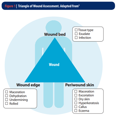 Diagram showing the triangle of wound assessment