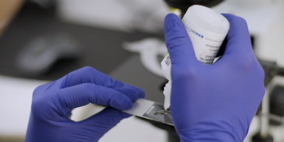 Nurse preparing a slide for microscope