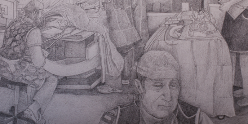 Black and white pencil drawing showing an operating theatre where an angioplasty is carried out.