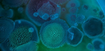 Aspergillus-mould-close-up-