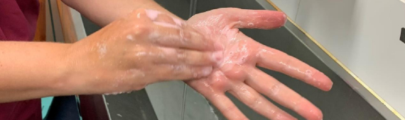 Pre theatre nursing handwashing