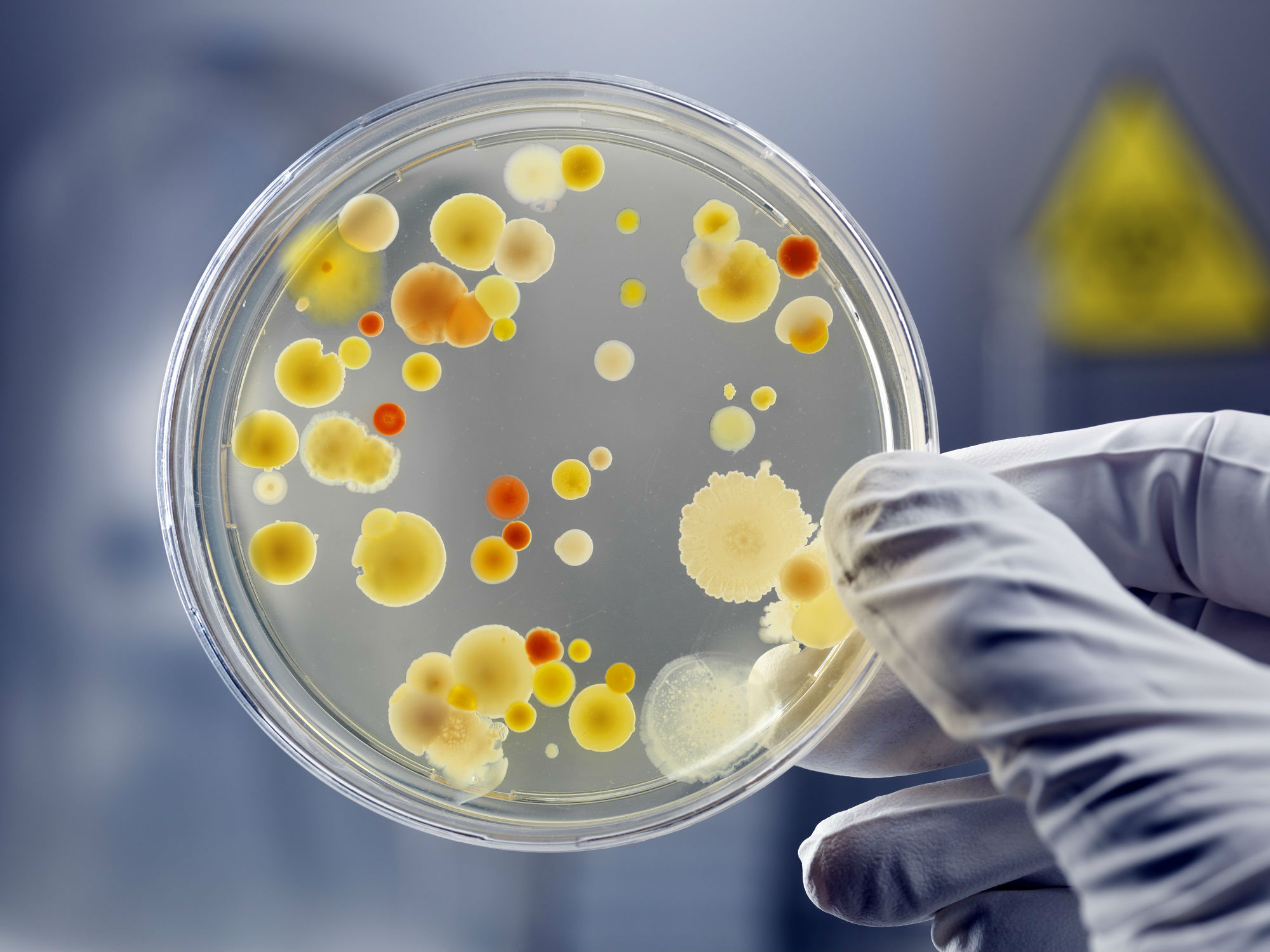 superbug