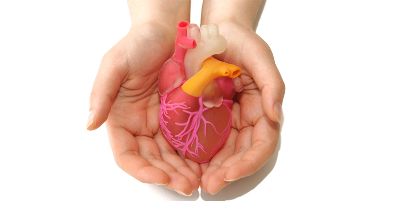Organ donation 2