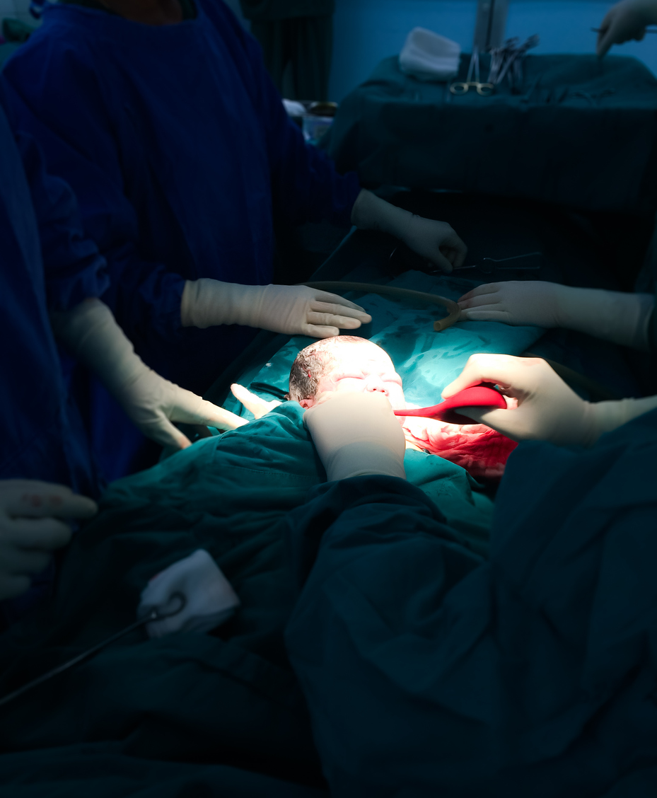 c section portrait