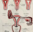 RCN Wandering Womb exhibition