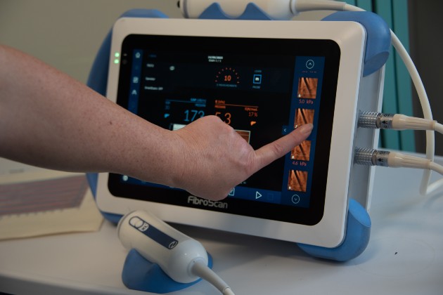 Equipment for heptology nursing