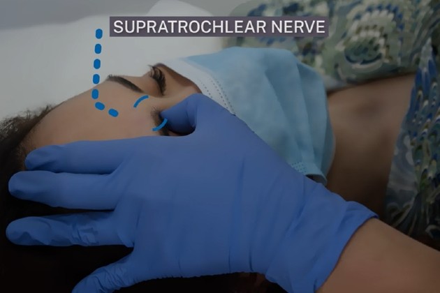 ANP touching patient's forehead to find the location for a supratrochlear nerve block injection