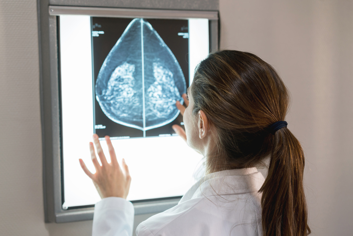 Breast screening